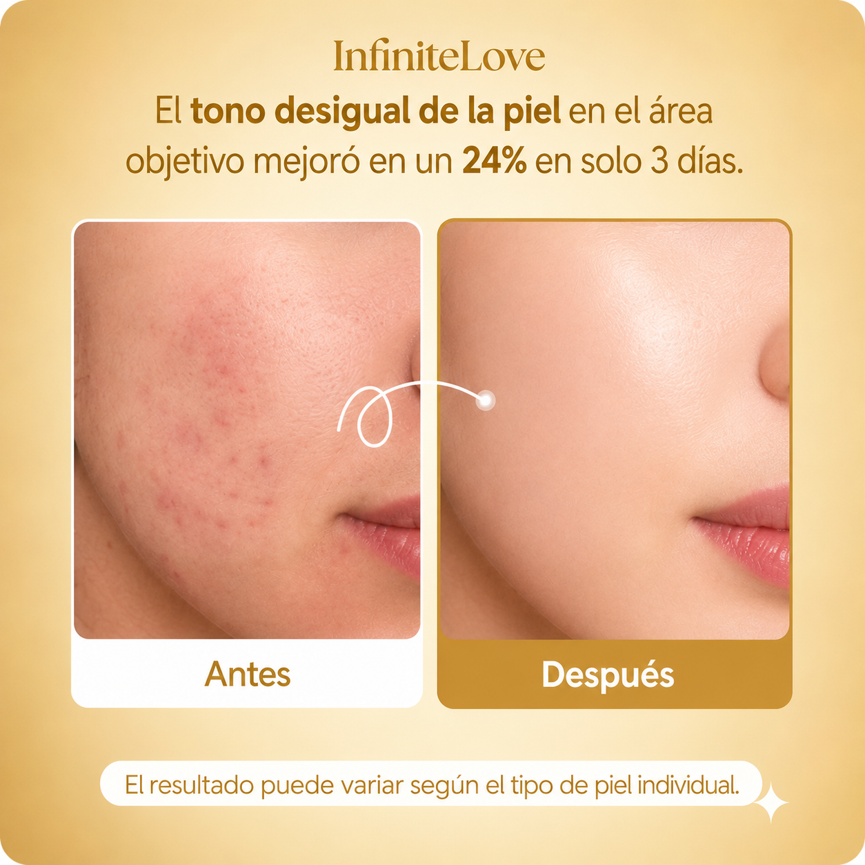 Mascarilla Coreana Nocturna para Manchas, Melasma y Brillo Instantáneo
