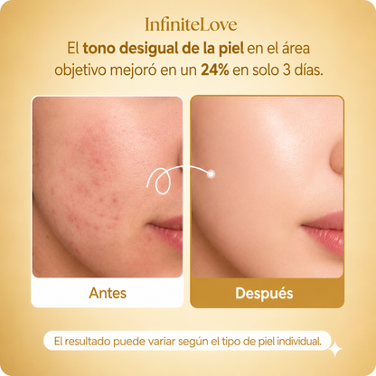 Mascarilla Coreana Nocturna para Manchas, Melasma y Brillo Instantáneo